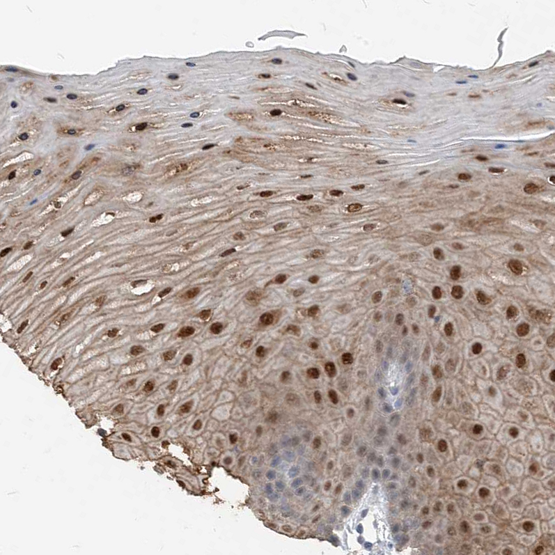 Anti-NCOA7 Antibody