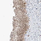 Anti-NCOA7 Antibody