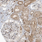 Immunohistochemical staining of human kidney shows moderate nuclear positivity in cells in glomeruli.