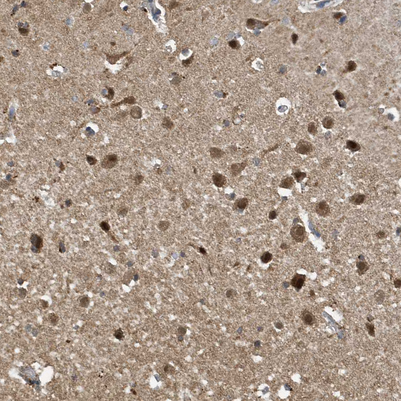 Anti-NCOA7 Antibody