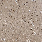 Anti-NCOA7 Antibody