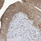 Immunohistochemical staining of human urinary bladder shows moderate nuclear and cytoplasmic positivity in urothelial cells.