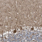 Immunohistochemical staining of human cerebellum shows moderate to strong cytoplasmic and nuclear positivity in Purkinje cells.