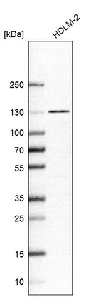 Western blot analysis in human cell line HDLM-2.
