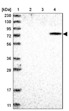 Lane 1: Marker [kDa] 230, 130, 95, 72, 56, 36, 28, 17, 11_br/_Lane 2: Human cell line RT-4_br/_Lane 3: Human cell line U-251MG sp_br/_Lane 4: Human plasma (IgG/HSA depleted)