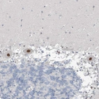 Anti-METAP1D Antibody