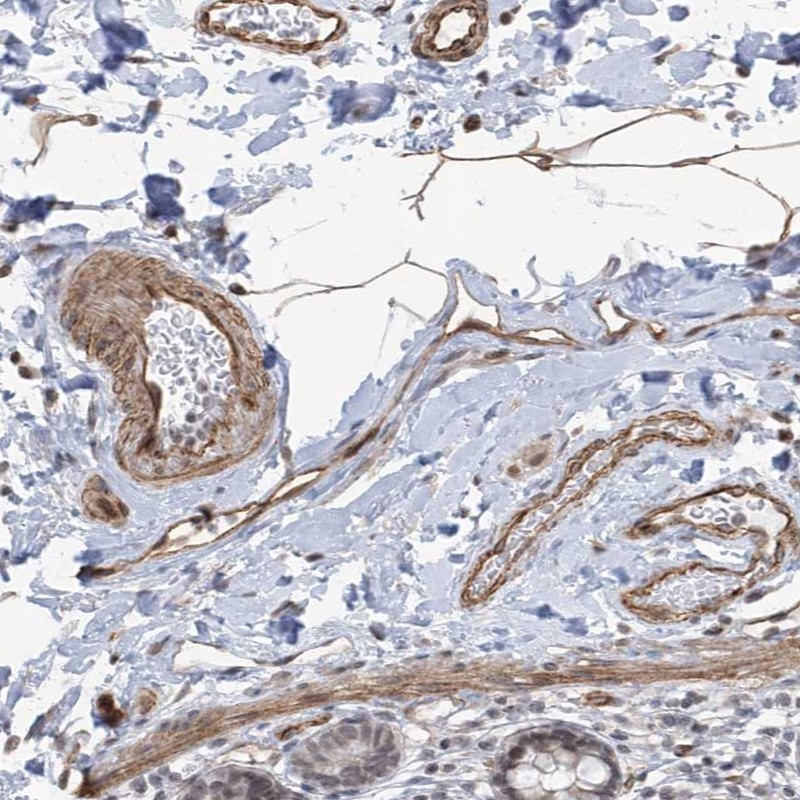 Anti-METAP1D Antibody