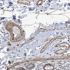 Anti-METAP1D Antibody