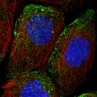 Immunofluorescent staining of human cell line A-431 shows localization to vesicles.