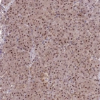 Anti-DEAF1 Antibody