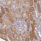 Immunohistochemical staining of human kidney shows strong cytoplasmic and nuclear positivity in trophoblastic cells.