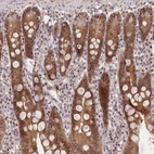 Immunohistochemical staining of human small intestine shows strong cytoplasmic and nuclear positivity in glandular cells.