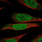 Immunofluorescent staining of human cell line U-2 OS shows positivity in nucleus & nucleoli.