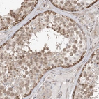 Anti-TYSND1 Antibody