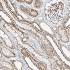 Immunohistochemical staining of human kidney shows moderate granular cytoplasmic positivity in cells in tubules.