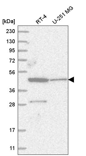 Anti-ZNF586 Antibody
