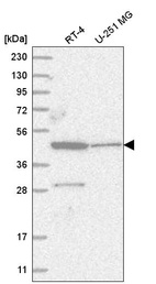 Anti-ZNF586 Antibody