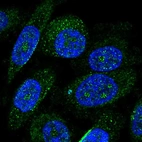 Immunofluorescent staining of human cell line PC-3 shows localization to nucleoli fibrillar center & vesicles.