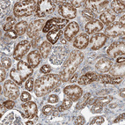 Immunohistochemical staining of human kidney shows strong granular cytoplasmic positivity in cells in tubules.