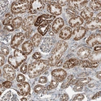 Immunohistochemical staining of human kidney shows strong granular cytoplasmic positivity in cells in tubules.