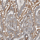 Immunohistochemical staining of human small intestine shows strong granular cytoplasmic positivity in glandular cells.