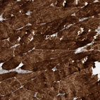 Immunohistochemical staining of human skeletal muscle shows strong cytoplasmic positivity in myocytes.