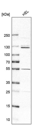 Western blot analysis in human cell line HEL.