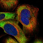 Immunofluorescent staining of human cell line U-2 OS shows localization to cytosol.
