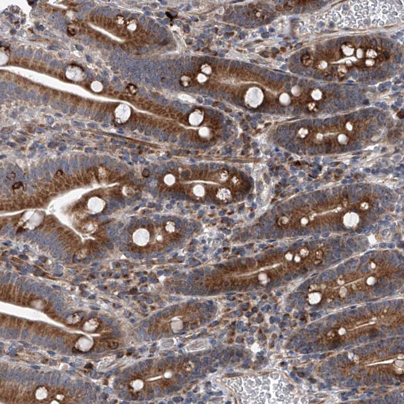 Anti-DLGAP2 Antibody