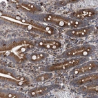 Anti-DLGAP2 Antibody