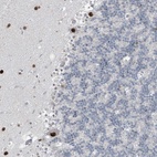Anti-PRDM6 Antibody