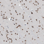 Anti-PRDM6 Antibody