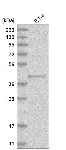 Anti-PM20D2 Antibody