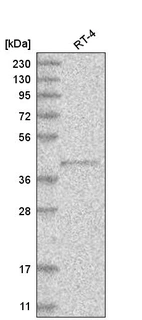 Anti-PM20D2 Antibody