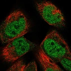 Immunofluorescent staining of human cell line RH-30 shows localization to nucleoplasm.