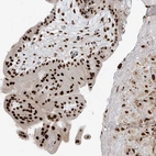 Anti-PM20D2 Antibody