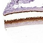 Immunohistochemical staining of human eye, retina shows strong cytoplasmic positivity in photoreceptor cells.