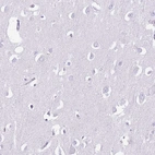 Immunohistochemical staining of human cerebral cortex shows no positivity in neurons as expected.