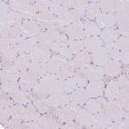 Immunohistochemical staining of human skeletal muscle shows no positivity in myocytes as expected.