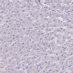 Immunohistochemical staining of human liver shows no positivity in hepatocytes as expected.