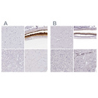 Anti-IMPG1 Antibody