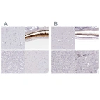 Anti-IMPG1 Antibody