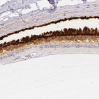 Immunohistochemical staining of human eye, retina using Anti-IMPG1 antibody HPA030333.
