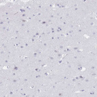 Immunohistochemical staining of human cerebral cortex shows no positivity in neurons as expected.