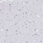 Immunohistochemical staining of human cerebral cortex shows no positivity in neurons as expected.
