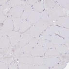 Immunohistochemical staining of human skeletal muscle shows no positivity in myocytes as expected.
