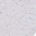 Immunohistochemical staining of human skeletal muscle shows no positivity in myocytes as expected.