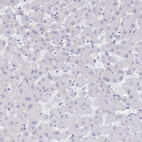 Immunohistochemical staining of human liver shows no positivity in hepatocytes as expected.