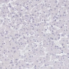 Immunohistochemical staining of human liver shows no positivity in hepatocytes as expected.