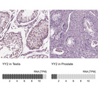 Anti-YY2 Antibody